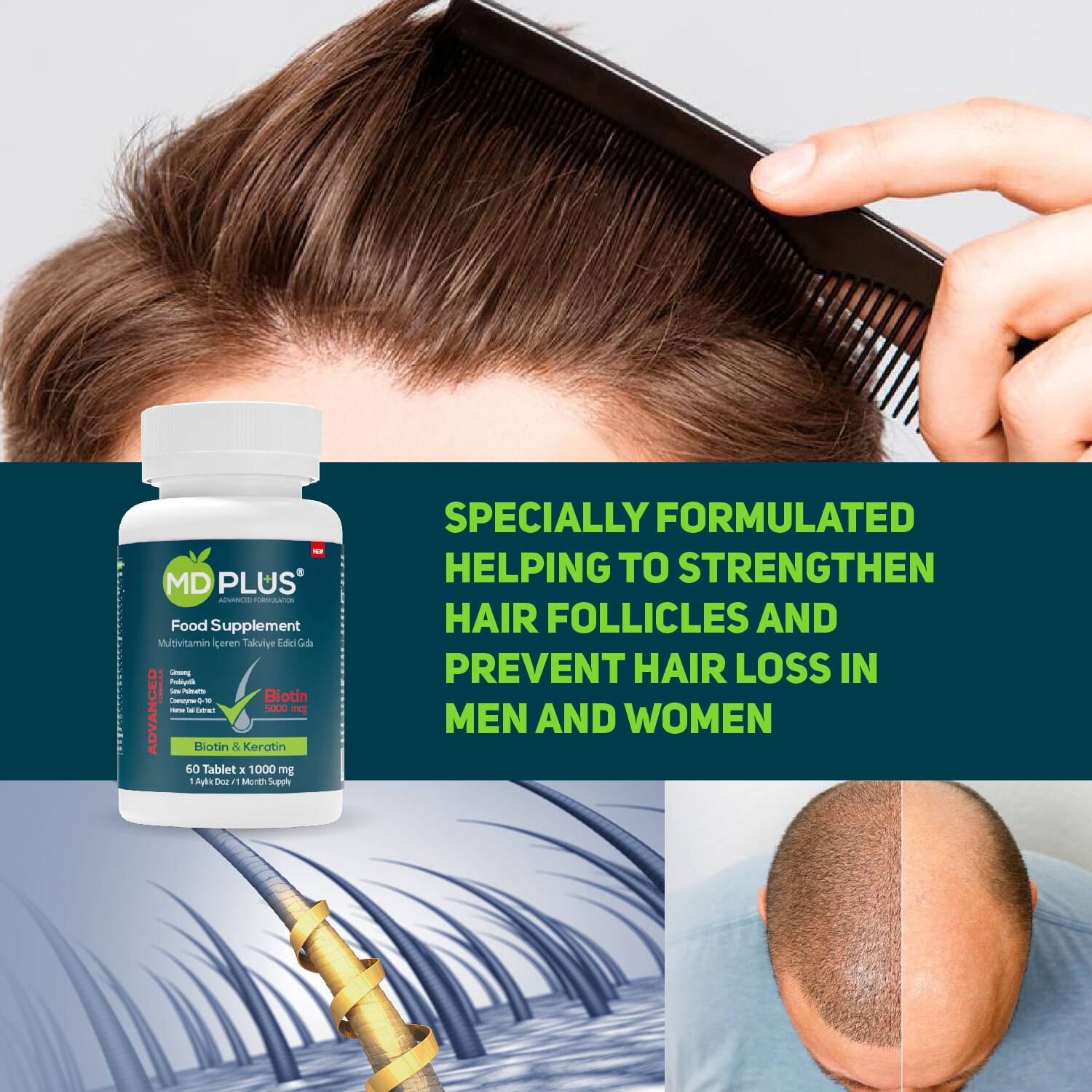 MD Plus Advanced Hair Multivitamin 60 Tablet | HairMD Clinical Series  Products